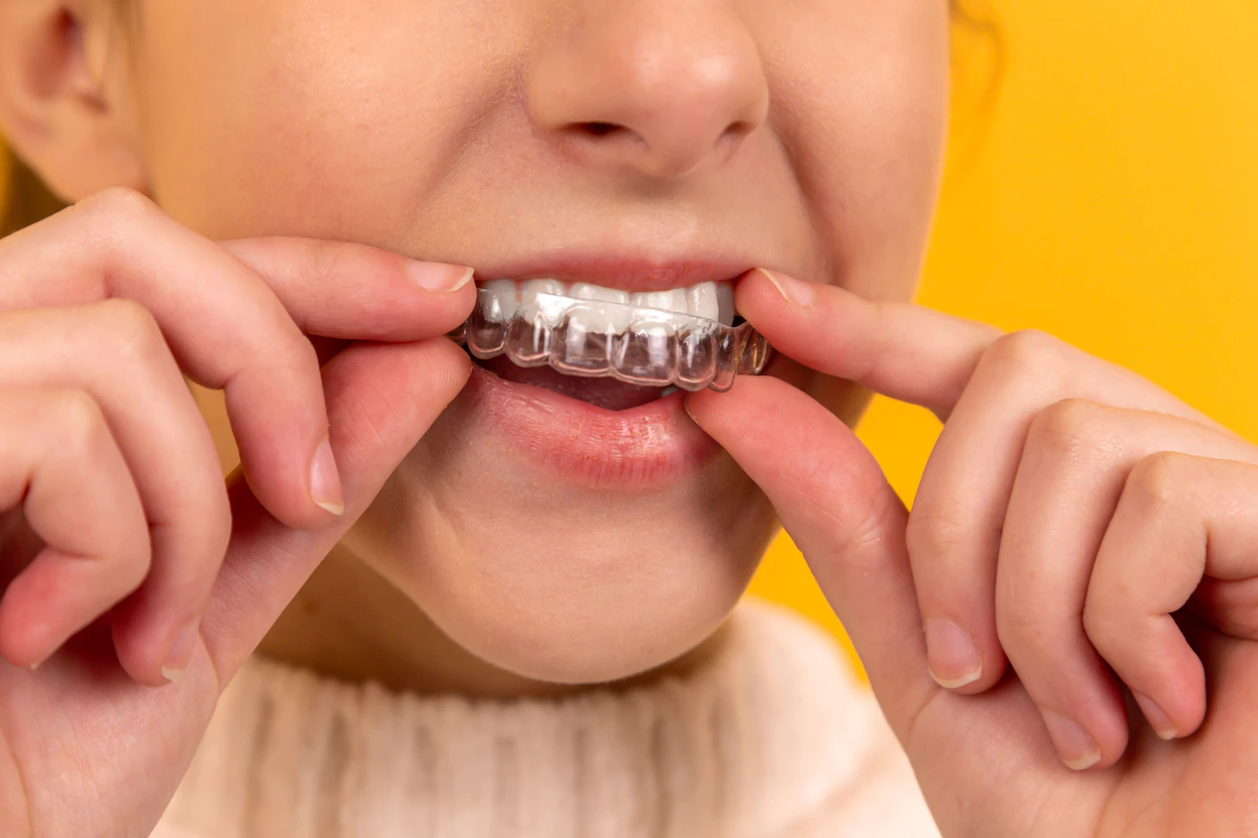 Dental implants in Charlotte — single tooth, full arch, and bone grafting